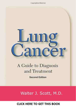 Lung Cancer - A Guide to Diagnosis and Treatment